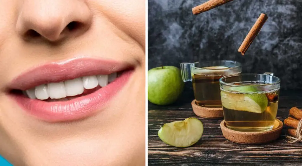 Dental Plaque: The Silent Killer of Your Teeth and Gums – How to Naturally Get Rid of It at Home!