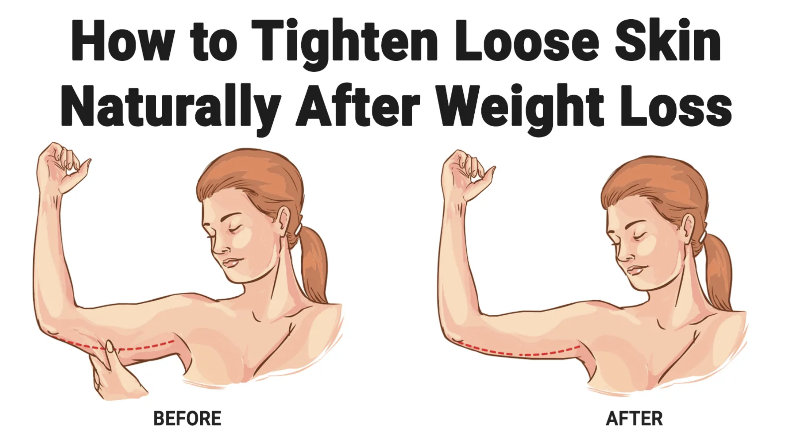 Natural Ways To Tighten Sagging Skin After Weight Loss